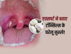 टॉन्सिल्स की वजह से खाने-पीने में हो रही है परेशानी? आयुर्वेदाचार्य से जानिए इससे छुटकारा पाने के असरदार उपाय