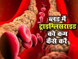 सफेद चीनी और रिफाइंड तेल है हाई ट्राइग्लिसराइड की वजह! जानिए Tryglycerides कम करने के लिए क्या खाएं क्या न खाएं