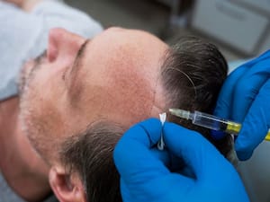 Tired of Hair Loss? Growth Factor Concentrate (GFC) Therapy For Hair