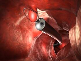 If You   re 45 Or Older, Colorectal Cancer Screening Is Recommended
