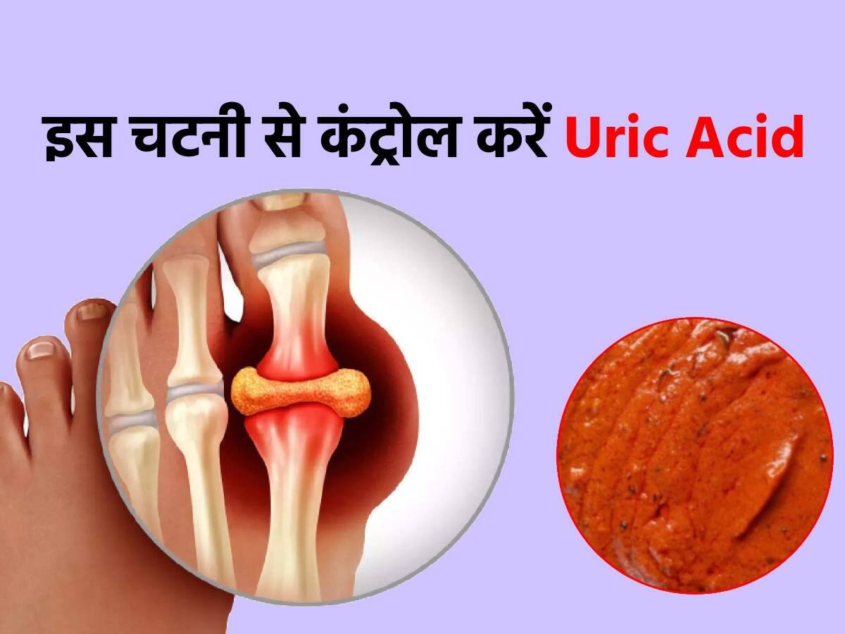 Chutney for Uric Acid इस खास चटनी से करें यूरिक एसिड की समस्याओं को