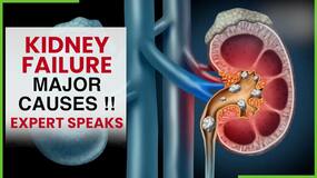 Kidney Stone: Know The Reason Behind Major Cases Of Kidney Failure, Expert Speaks, Watch Video
