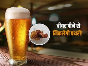 बीयर पीने से निकल जाती है गुर्दे की पथरी? हर 3 में से एक भारतीय की राय कितनी सही, जानें एक्सपर्ट से