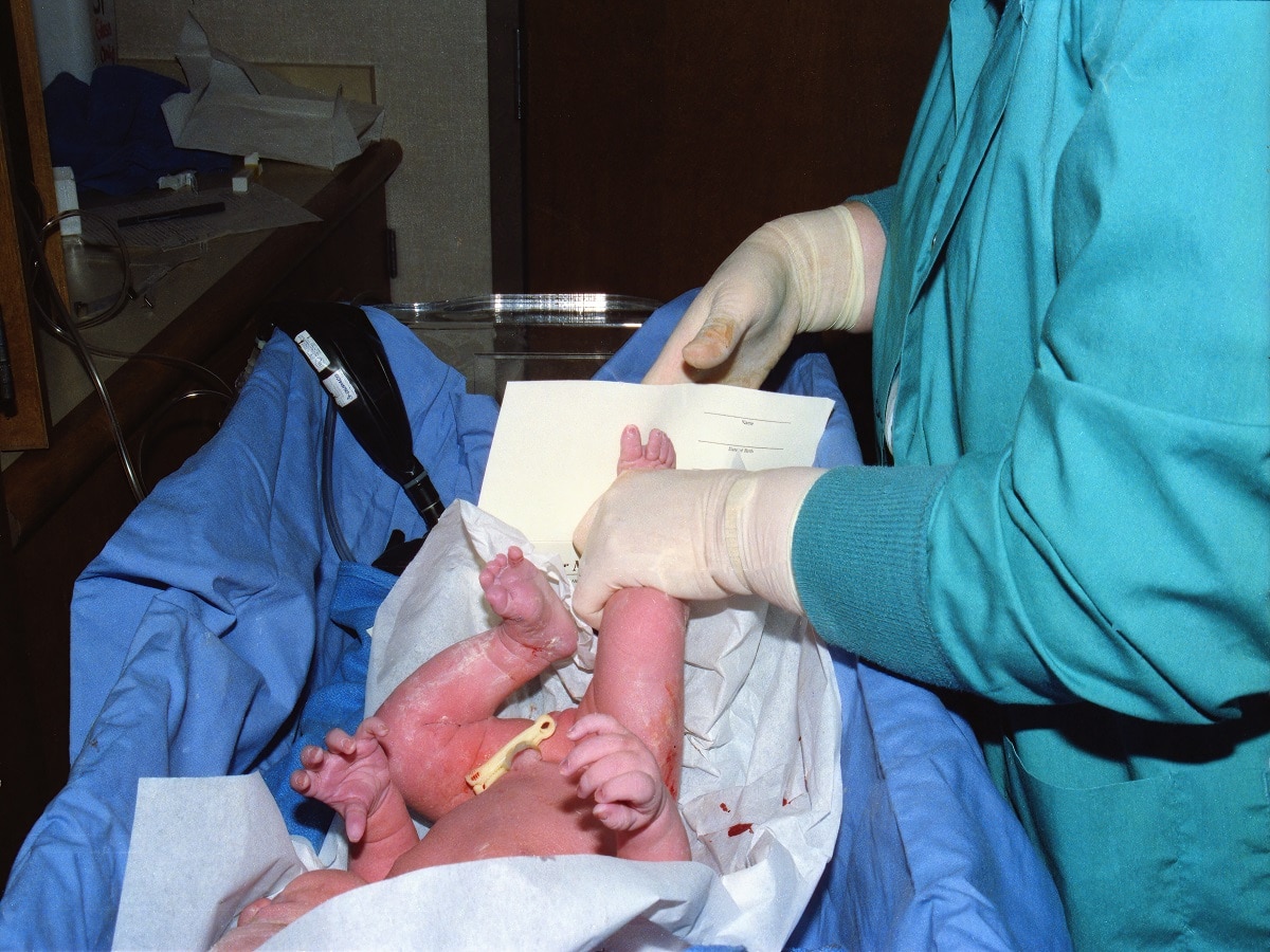 Birth Asphyxia: When The Child Is Born Without Enough Oxygen