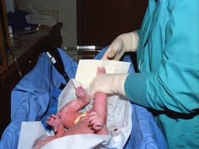 Birth Asphyxia: When The Child Is Born Without Enough Oxygen
