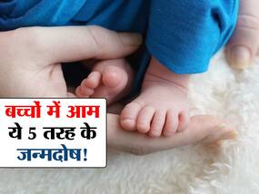 नवजात बच्चों में ये 5 तरह के जन्मदोष होते हैं बहुत ही आम! जानें कौन से दोष हो सकते हैं जन्म के बाद ठीक