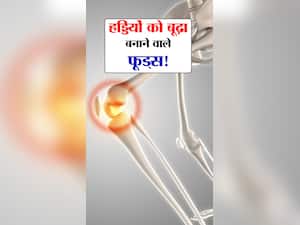 हड्डियों को 'बूढ़ा' बनाने वाले 8 फूड्स