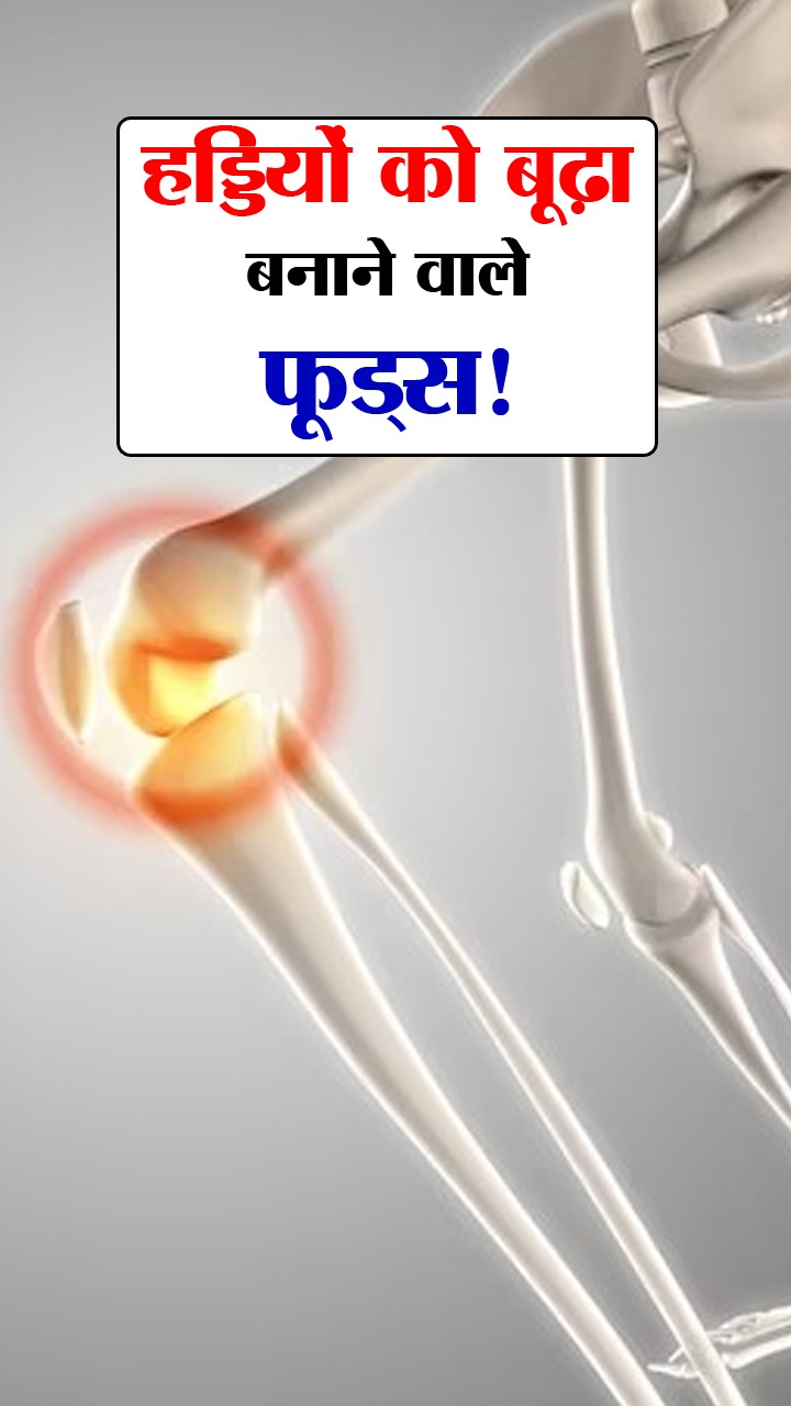 हड्डियों को 'बूढ़ा' बनाने वाले 8 फूड्स