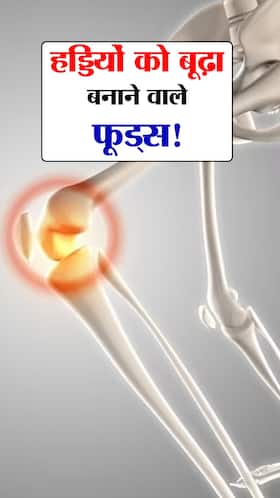 हड्डियों को 'बूढ़ा' बनाने वाले 8 फूड्स