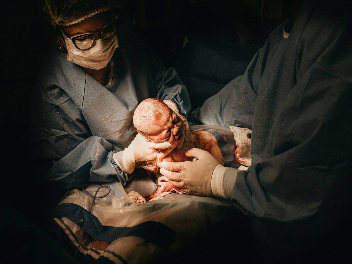 C-section : Top and Latest News, Articles, Videos and Photo About C-section