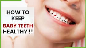 Kids Dental Health: Tips To Keep Your Baby's Primary Teeth Healthy & Cavity Free, Expert Speaks, Watch Video