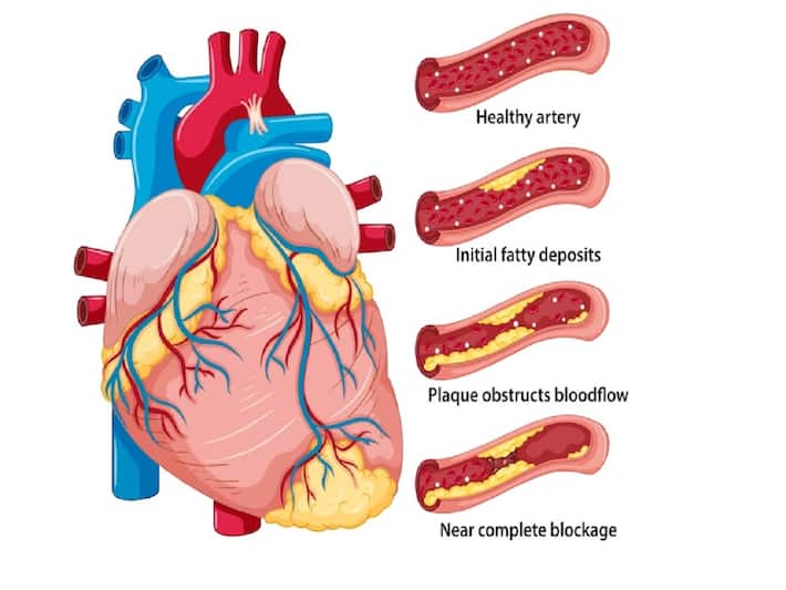 Vitamin D And Calcium What's The Connection?