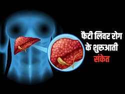 फैटी लिवर होने पर सबसे पहले शरीर के इन 3 भागों में महसूस होता है दर्द, जानिए कब दिखते हैं फैटी लिवर के लक्षण