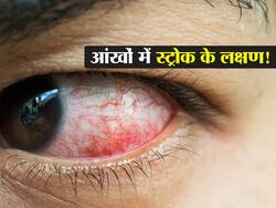 दिल और दिमाग में नहीं आंखों में भी होता है Stroke!जानें आई स्ट्रोक में दिखाई देने वाले शुरुआती लक्षण