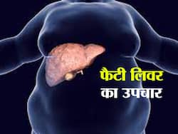 इन 4 तरीकों से अपने आप ठीक हो जाता है लिवर पर जमा फैट! जानिए फैटी लिवर का प्राकृतिक उपचार