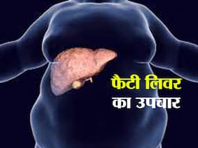 इन 4 तरीकों से अपने आप ठीक हो जाता है लिवर पर जमा फैट! जानिए फैटी लिवर का प्राकृतिक उपचार