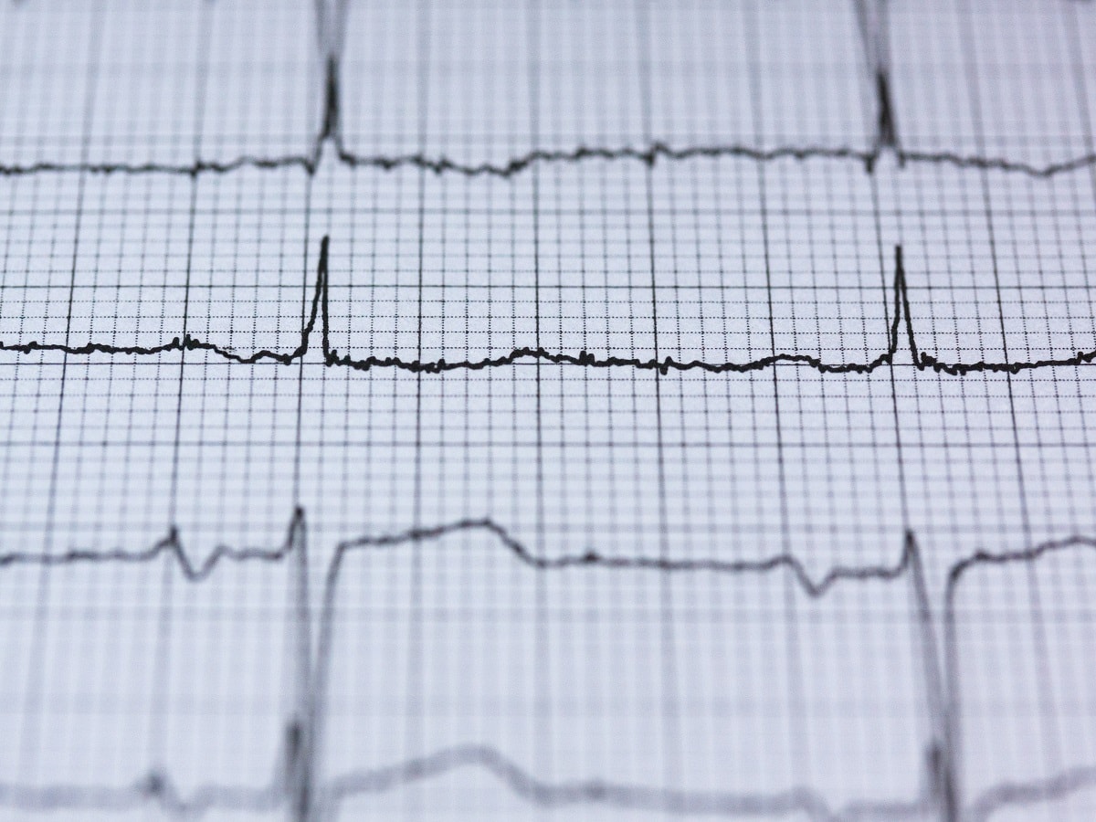 Heart Attack Recovery: Can Muscle Death Be Reversed?