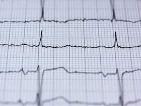 Half Of World   s Adults Over 40 Might Have Hidden Heart Disease: Study
