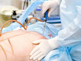 Laparoscopic Surgery: Why Should Women Go For It?