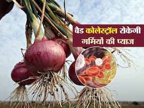 गर्मियों के ठंडे प्याज निकालेंगे नसों में जमा बैड कोलेस्ट्रॉल, जानें किस तरीके से सेवन ज्यादा फायदेमंद