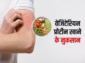 इन प्रोटीन रिच फूड्स से हो सकती है गम्भीर एलर्जी, स्किन और हाथों-पैरों में दिख सकते हैं रिएक्शन्स, पढ़ें डिटेल्स