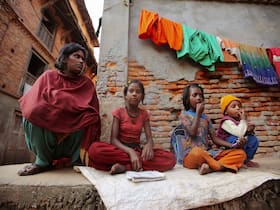 Tuberculosis: Not Just A Matter Of Poverty But Of Compromised Immunity Tuberculosis: Not Just A Matter Of Poverty But Of Compromised Immunity