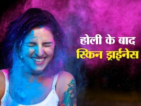 होली के दौरान छोटी-छोटी गलतियों के कारण होने लगती है Dry skin, डॉक्टर ने बताया घर पर इलाज करने का तरीका होली के दौरान छोटी-छोटी गलतियों के कारण होने लगती है Dry skin, डॉक्टर ने बताया घर पर इलाज करने का तरीका
