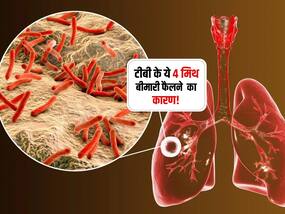 TB से जुड़े इन 4 मिथ पर बिल्कुल भी न करें भरोसा! 90 फीसदी लोग सच मानकर पूरे शरीर में फैला लेते हैं टीबी