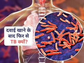 6-9 महीने खाई TB की दवा फिर भी दोबारा हुआ इंफेक्शन? ये 1 गलती आपको बनाती है बार-बार टीबी का शिकार