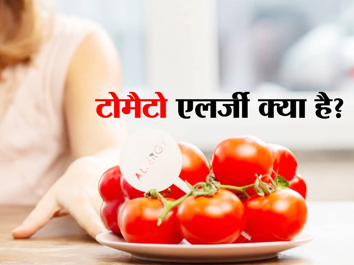 Tomato Allergy कुछ लोगों को टमाटर से भी होती है एलर्जी, जानिए क्या है
