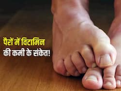 विटामिन बी12 की कमी के ऐसे लक्षण जिन्हें पकड़ पाना है मुश्किल,पैरों में दिखायी देती है यह बड़ी समस्या भी
