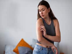 Exercise-Induced Urticaria: Physical Activities Can Also Trigger Allergies