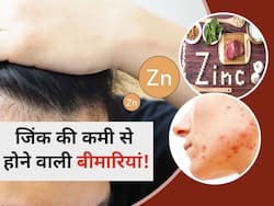 शरीर में इस मिनरल की कमी से होती हैं ये 5 बड़ी परेशानियां! जानें डेली रूटीन में होने वाली सबसे बड़ी दिक्कतें