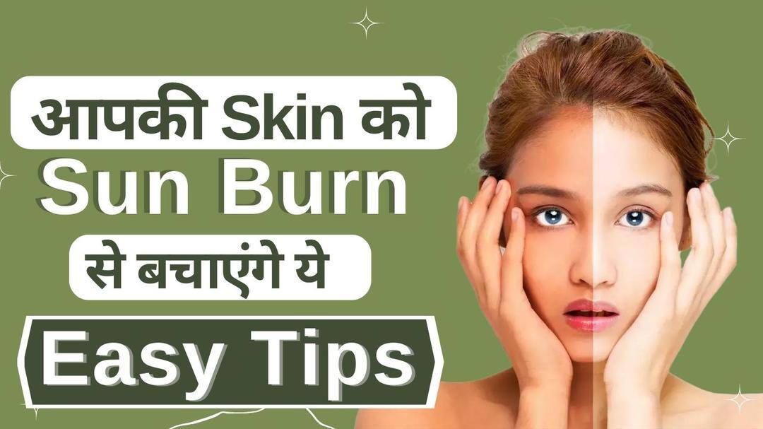 Skincare Tips Sun Burn से बचाव के लिए अपनाएं ये Summer Skin Care Tips