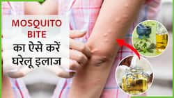 Mosquito Bite Remedies: मच्छरों के कारण हुई इस Skin Problem से ऐसे मिलेगा आराम