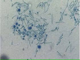 Killer Plant Fungus Kills A Professional Plant Mycologist In Kolkata Killer Plant Fungus Kills A Professional Plant Mycologist In Kolkata