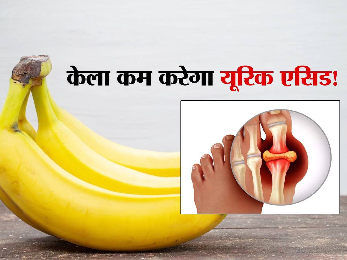 Uric Acid Me Kela Khane Ke Fayde यूरिक एसिड में केला खाने के फायदे