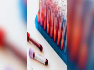 हेल्दी रहने के लिए साल में 1 बार जरूर कराएं ये 9 ब्लड टेस्ट