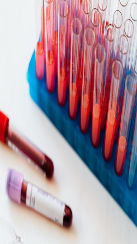 рд╣реЗрд▓реНрджреА рд░рд╣рдиреЗ рдХреЗ рд▓рд┐рдП рд╕рд╛рд▓ рдореЗрдВ 1 рдмрд╛рд░ рдЬрд░реВрд░ рдХрд░рд╛рдПрдВ рдпреЗ 9 рдмреНрд▓рдб рдЯреЗрд╕реНрдЯ