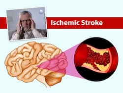 Diabetic Stroke: 10 Symptoms of High Blood Sugar Induced Brain Stroke
