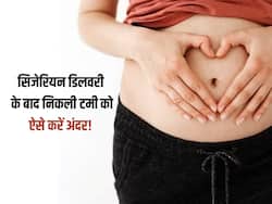 सिजेरियन डिलीवरी के बाद पेट आ गया है बाहार, इन 5 टिप्स से टमी को करें अंदर