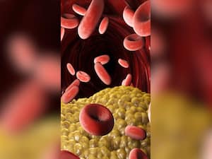 Top 10 Bad Cholesterol-Lowering Foods To Add To Your Diet