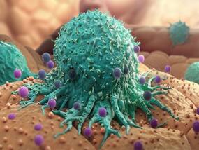 What Is Hereditary Cancer? Doctor Explains Risk Assessment, and Preventive Measures