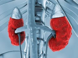 Chronic Kidney Disease: 10 Unusual Signs That Are Found In Indian Population