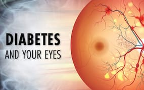 7 Unusual Symptoms of Diabetes In Eyes: Here's How A Diabetic Eye Looks Like