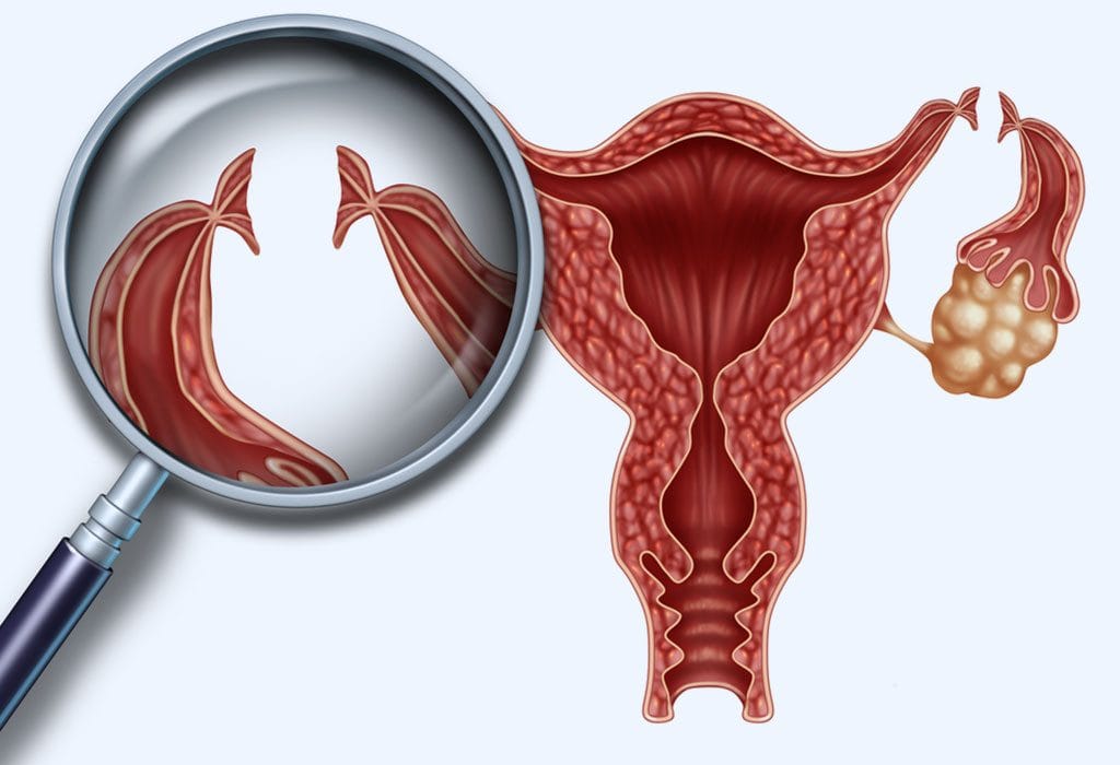 Fallopian Tube Reversal and Infertility, Know When To Reach Out To a