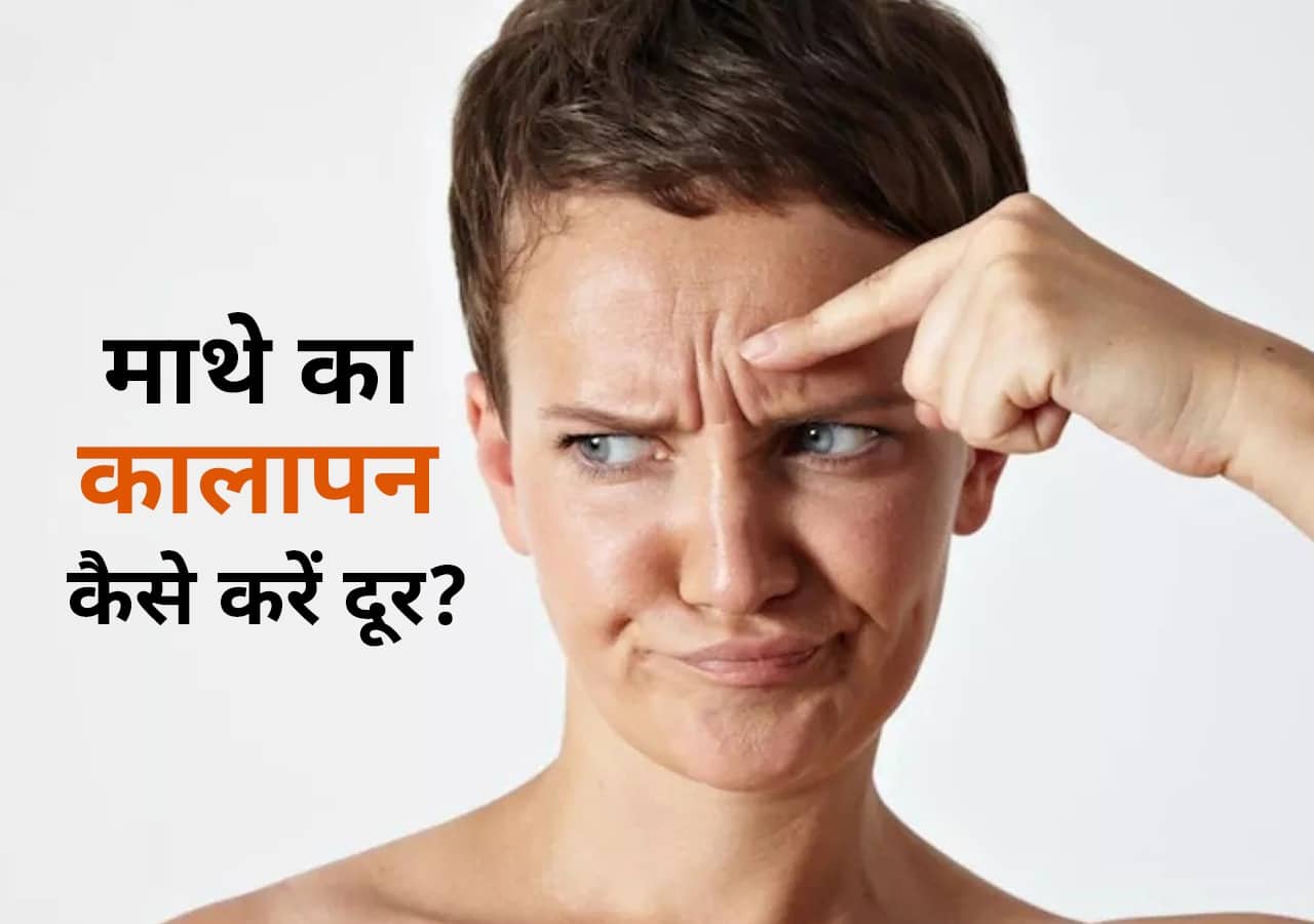 Forehead Blackness Remove धूलमिट्टी और पसीने से माथे पर रंग हो गया