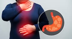 Acid Reflux: 12 Easy Home Remedies To Treat Gas And Acidity