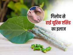 हाई यूरिक एसिड को जड़ से मिटाएगी ये 1 जड़ी-बूटी, इस तरह करें इस्तेमाल