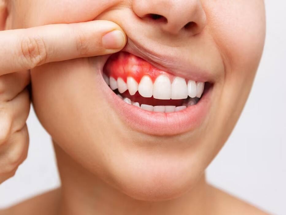 4 Most Common Oral Diseases: Causes And Prevention